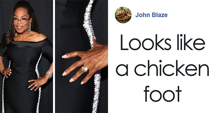 “Ozempic Hands” Is The Latest Skinny Side Effect No One Asked For: “Excuse Me While I Throw Up”